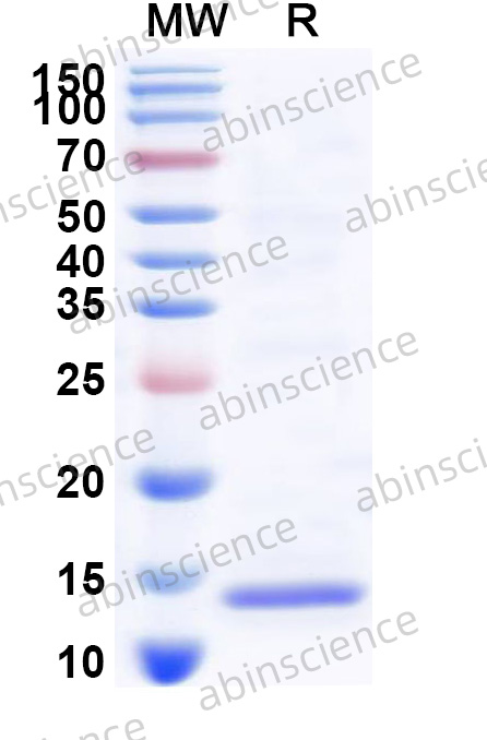 Human ANGPTL8 Recombinant Protein (N-Strep)