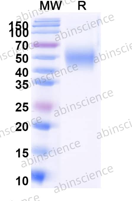 Human CDCP1 Recombinant Protein (C-His)