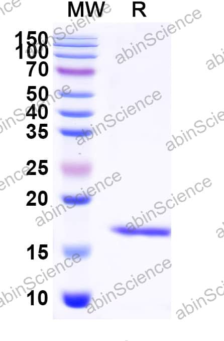Anti-Human IL23R Recombinant Nanobody (SAA2282)