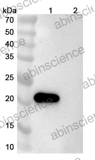 Anti-Human CD357/TNFRSF18/GITR Antibody (SAA2342)