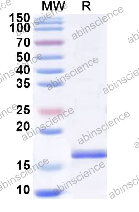 Human CD371/CLEC12A Recombinant Protein (N-His)