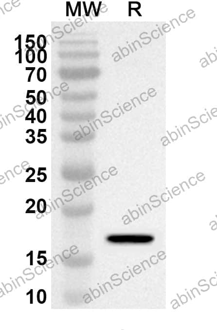 Anti-Human CD371/CLEC12A Polyclonal Antibody