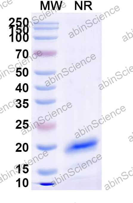 Anti-Human IGHM Recombinant Nanobody (SAA2369)