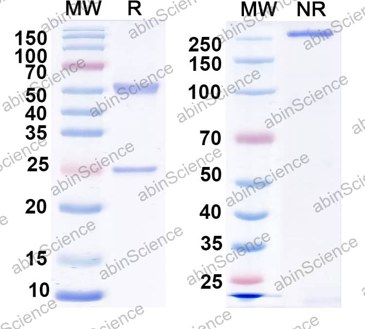 Anti-Human IgM Monoclonal Antibody (1A184)