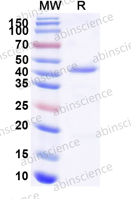 Human MYO5A Recombinant Protein (N-His)