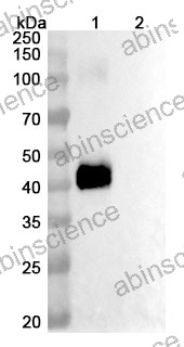 Anti-Human CD3 epsilon&TMEFF2/Tomoregulin-2 Reference Antibody (Ciduvectamig, RUO)
