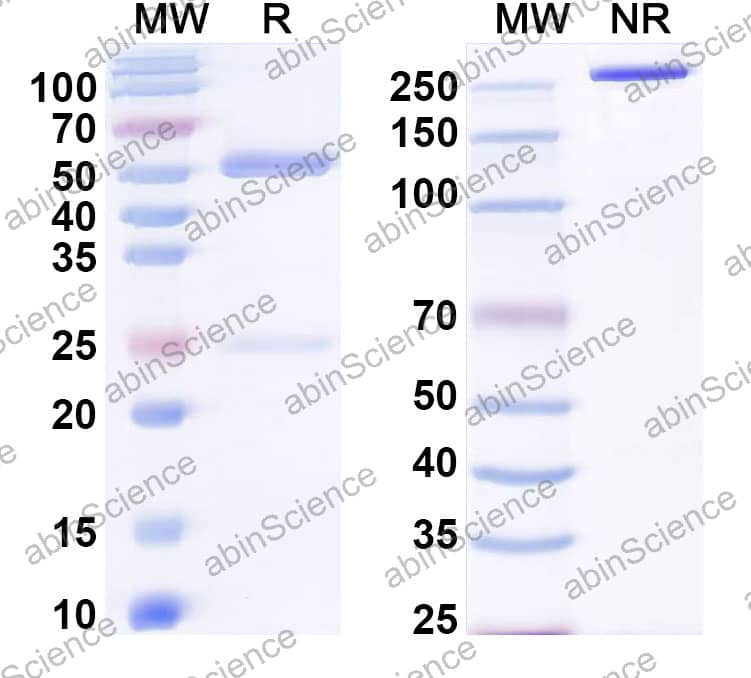 Anti-Human IL-1 RAcP/IL-1 R3 Recombinant Antibody (SAA2359)