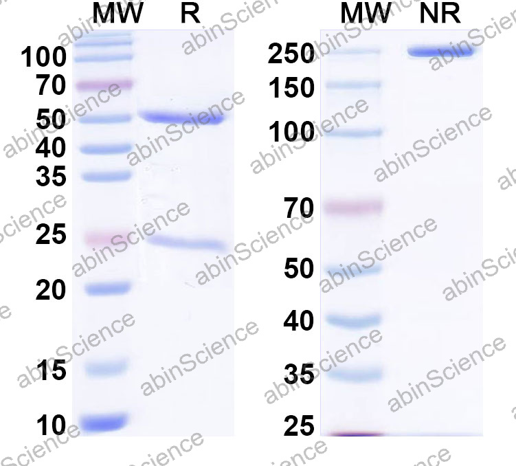 Anti-Human CD57/B3GAT1 Monoclonal Antibody (1A589)