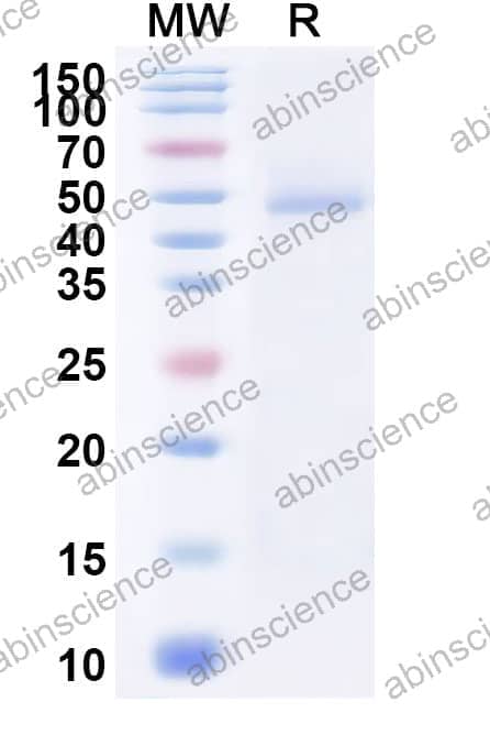 Human BAFFR/TNFRSF13C Recombinant Protein (C-His)