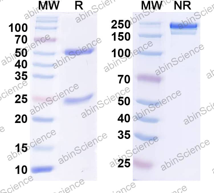 Anti-Human IgA Monoclonal Antibody (1A196)