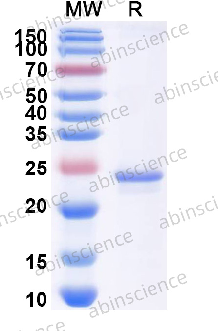 Human MMP24 Recombinant Protein (N-His)