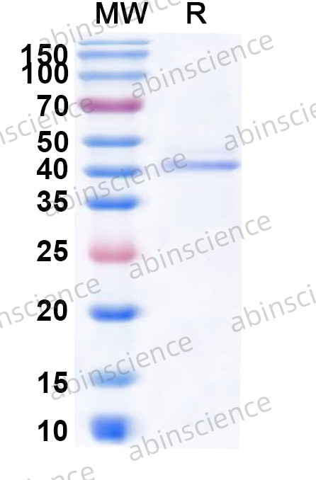Human APOBEC3B Recombinant Protein (N-His)