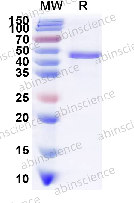Human CYLD Recombinant Protein (N-His)
