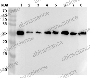 Anti-AK3 Polyclonal Antibody