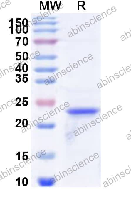 Human LAIR1 Recombinant Protein (N-His)