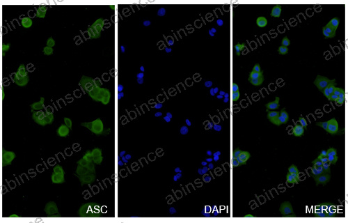 Anti-Human ASC/TMS1/PYCARD Recombinant Nanobody (SAA1187)