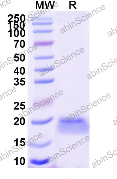 Anti-Human LGR4 Recombinant Nanobody (SAA2296)