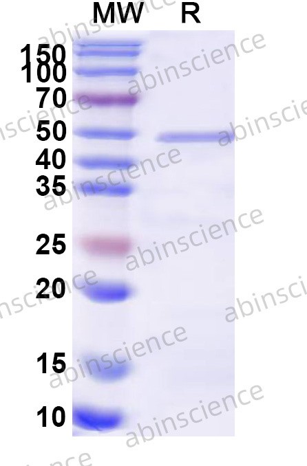 Human CYP26B1 Recombinant Protein (N-His)