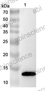 Anti-Human IL22 & IL13 & ALB Multispecific Reference Antibody (Donzakimig, RUO)