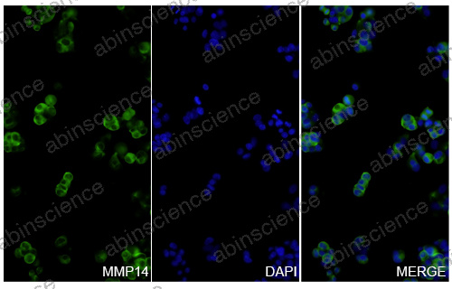 Anti-Human MMP-14/MT1-MMP Reference Antibody (RLVT 14-02, RUO)