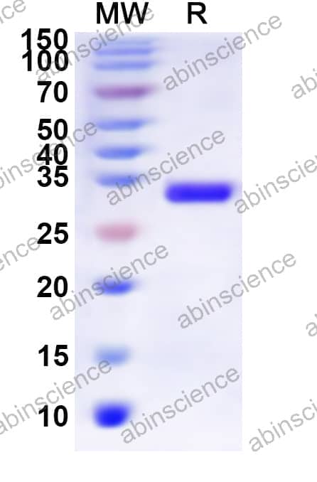Human GALR1 Recombinant Protein (N-His-KSI)
