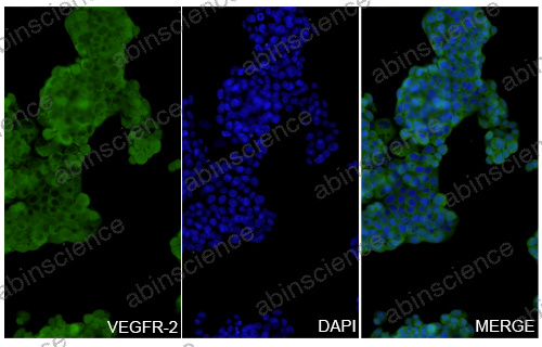 Anti-Human VEGFR2/KDR/Flk-1 Recombinant Nanobody (SAA1230)