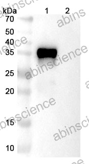 Anti-Human OX40 Ligand/TNFSF4 Reference Antibody (Gimistotug, RUO)