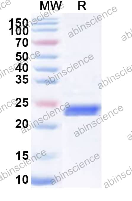 Human CLCN3 Recombinant Protein (N-His)