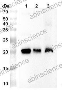 Anti-Human CAV2 Polyclonal Antibody