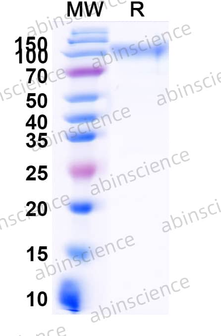 Human CD50/ICAM3 Recombinant Protein (C-His)