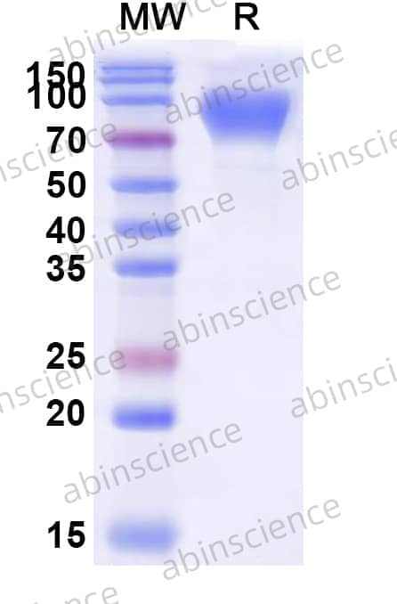 Human CEACAM6/CD66c Recombinant Protein (C-Fc)