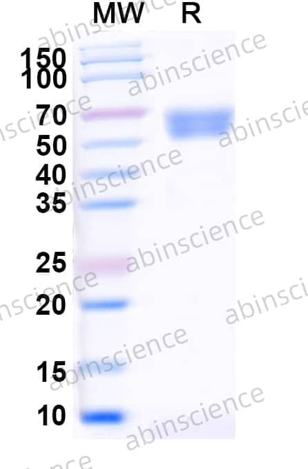 Human CD292/BMPR1A Recombinant Protein (C-Fc)