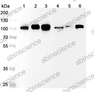 Anti-beta-Catenin Recombinant Antibody (SRR0912)