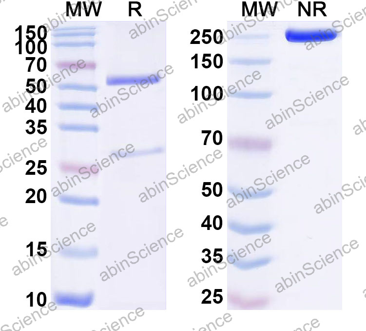 Anti-Human VHL Monoclonal Antibody (1A522)
