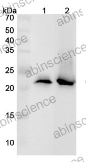 Anti-TNNI2 Polyclonal Antibody
