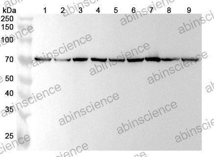 Anti-Human HSPA9/Mortalin/GRP75 Recombinant Antibody (SAA0812)