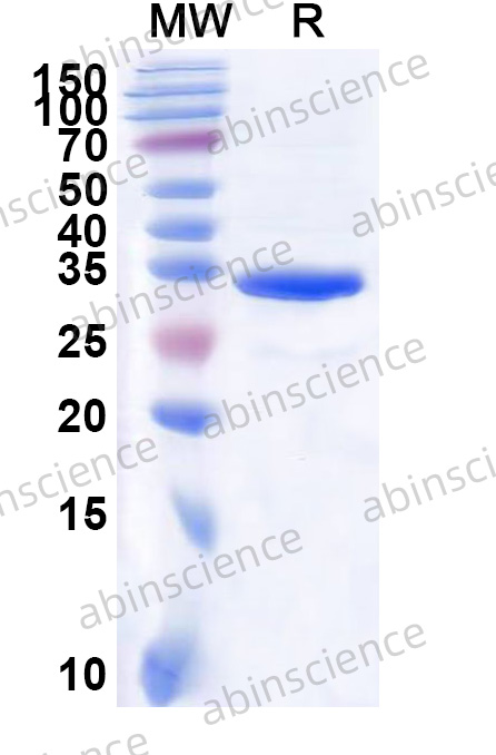 Human CHOP/GADD153/DDIT3 Recombinant Protein (N-GST & C-His)