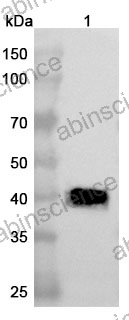 Anti-Human ATP7B Recombinant Nanobody (SAA1241)