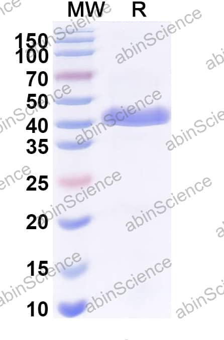 Anti-Human CD68/Macrosialin Recombinant Antibody (SAA2569)