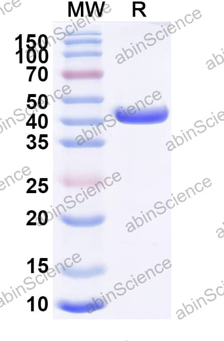 Anti-Human CD68/Macrosialin Recombinant Antibody (SAA2570)