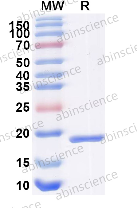 Anti-Human CD70 Recombinant Nanobody, C-Sortase tag (SAA2049)