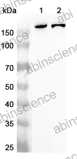 Anti-Human AGL Polyclonal Antibody