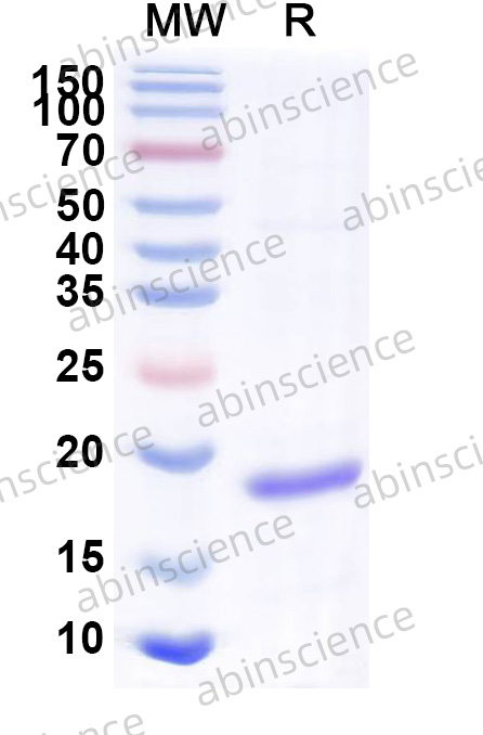 Recombinant Human RPL22 Protein, N-His