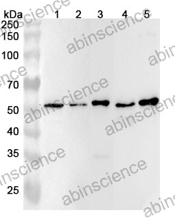 Anti-ANXA11 Polyclonal Antibody