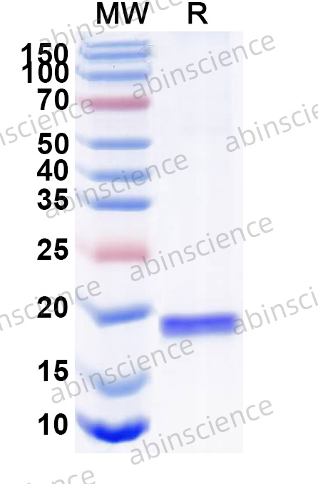 Anti-Human CD135/FLT3 Recombinant Nanobody, C-Sortase tag (SAA1328)