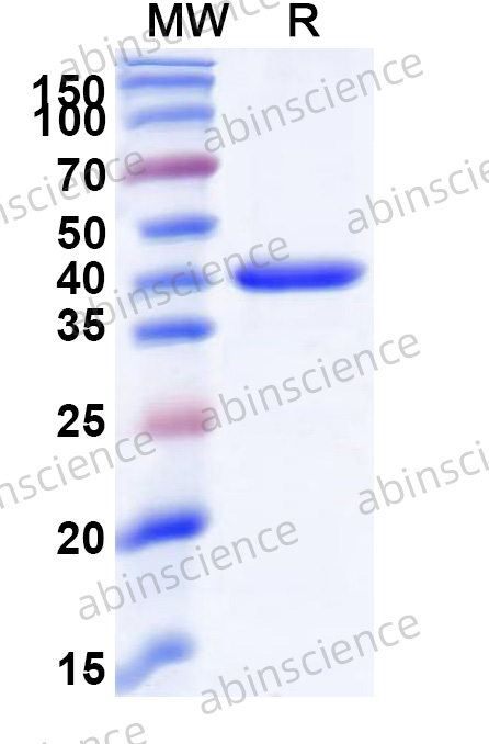 Human CASP2 Recombinant Protein (N-GST & C-His)