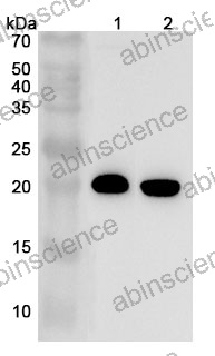 Anti-TAGLN2 Polyclonal Antibody