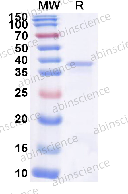 Human CD96 Recombinant Protein (N-His)