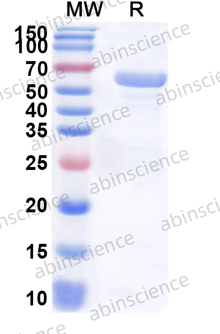 Human EPHX2 Recombinant Protein (N-His)