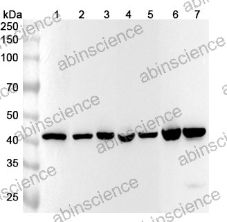 Anti-ACTB/β-actin/Beta Actin Recombinant Antibody (SAA0339)